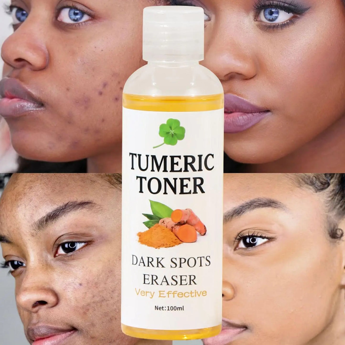 100Ml Turmeric Facial Toner Dark Spot Removal Turmeric Fade Blemishes Acne Remover Toner Moisturing Brightening Skin Care
